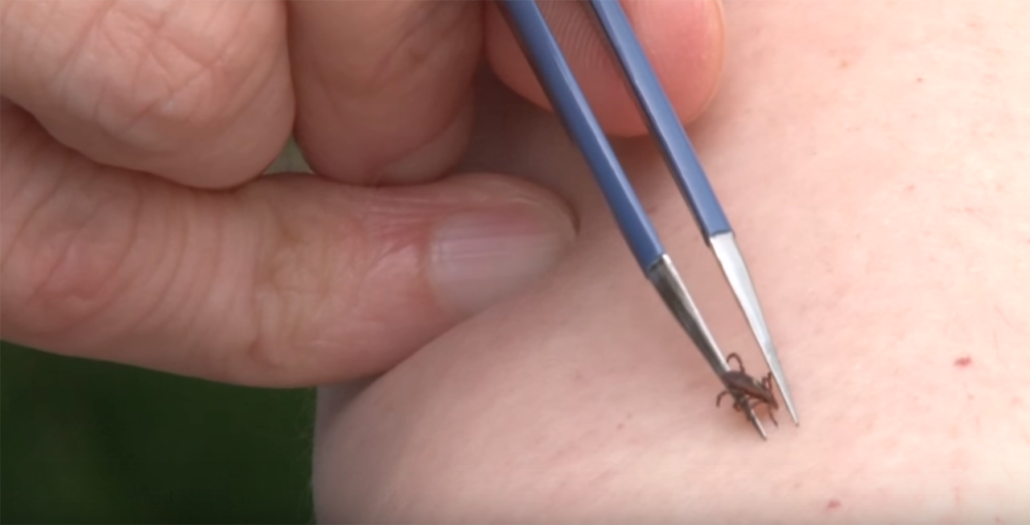 The Right Way to Remove a Tick