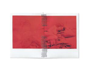 Red-tinted photo of person on bed with staples.
